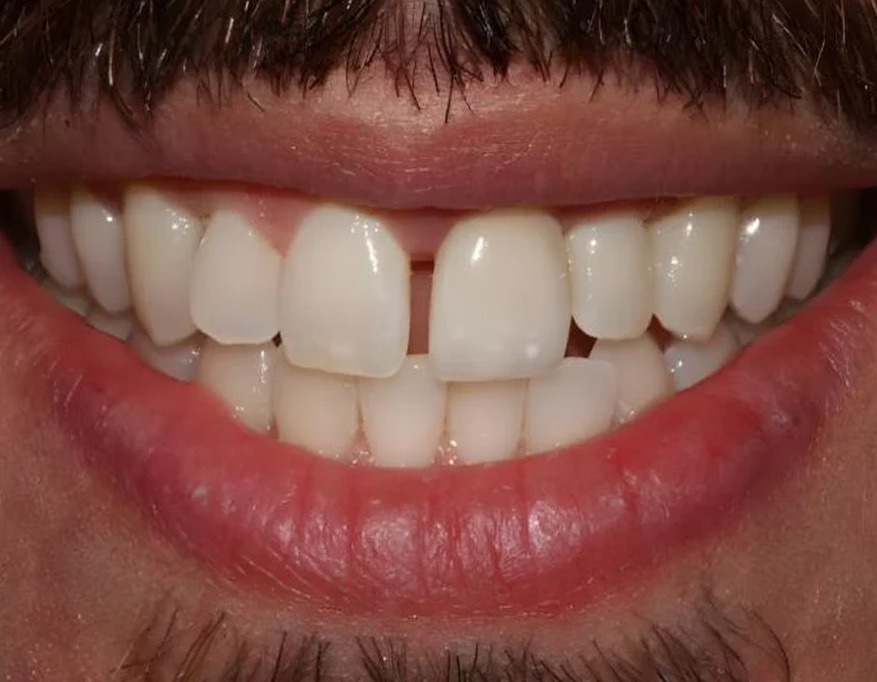 After