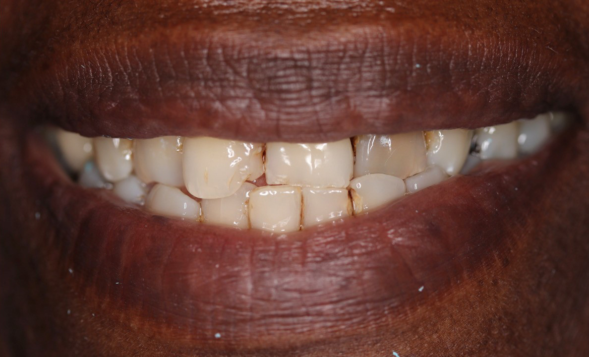 Before