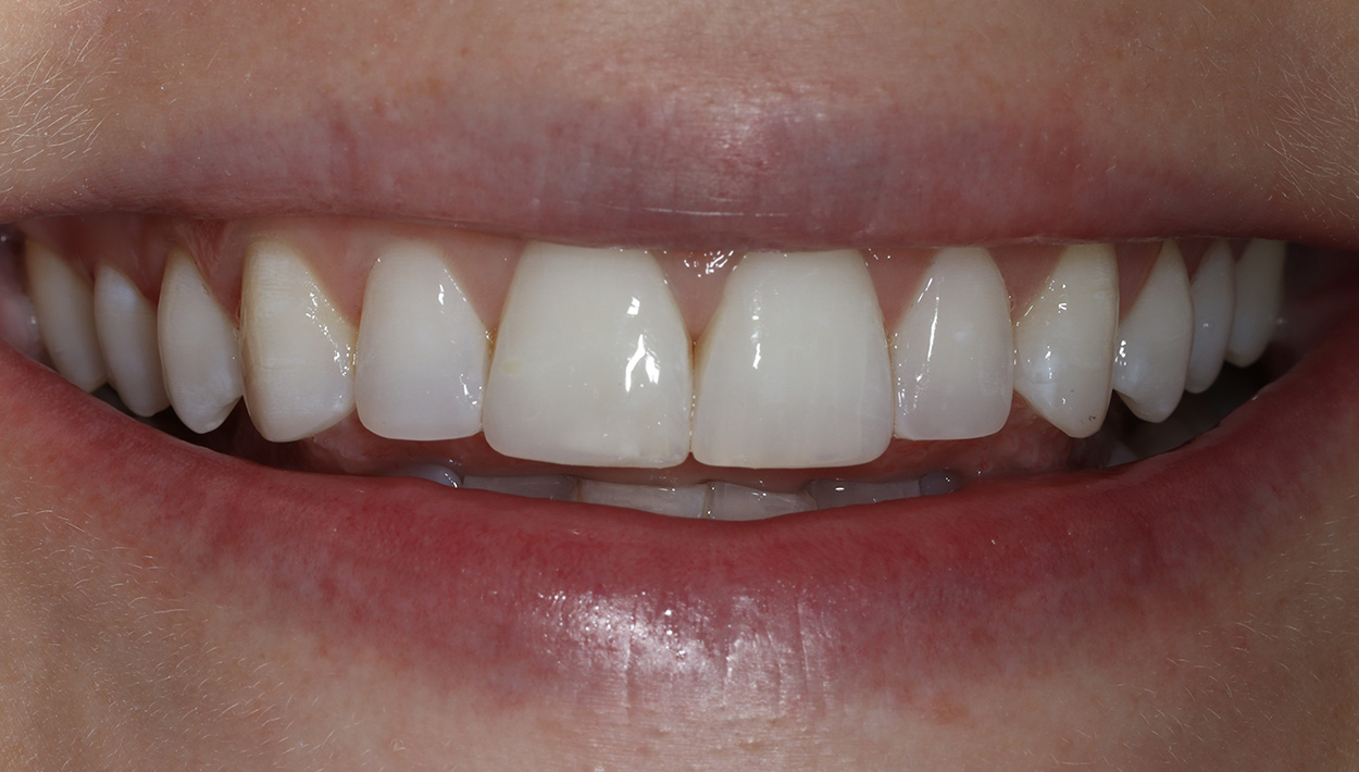 After