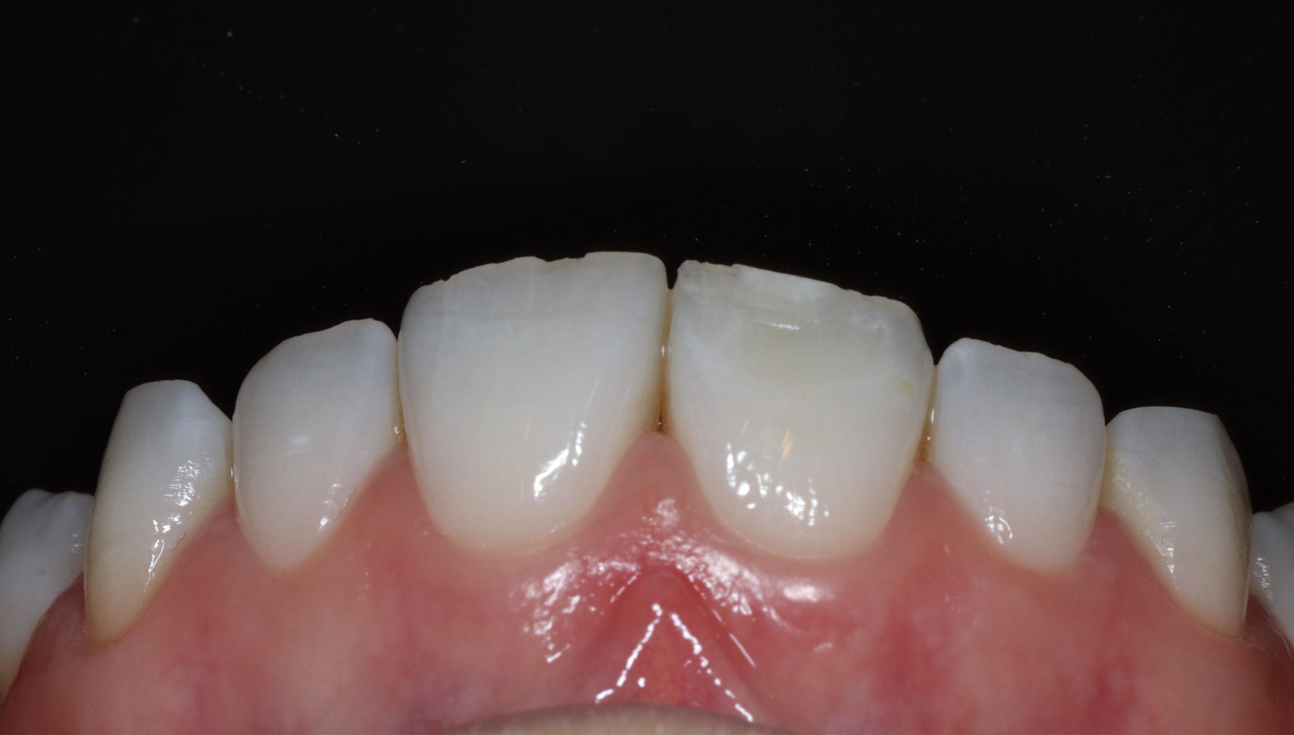 Before